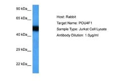 BRN3A Rabbit anti-Human, Polyclonal, Novus Biologicals 0.1ml; Unconjugated:Antibodies,